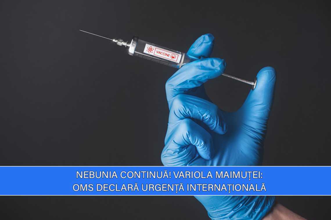 mpox_large Sănătate - Știrile Cronica Diasporei