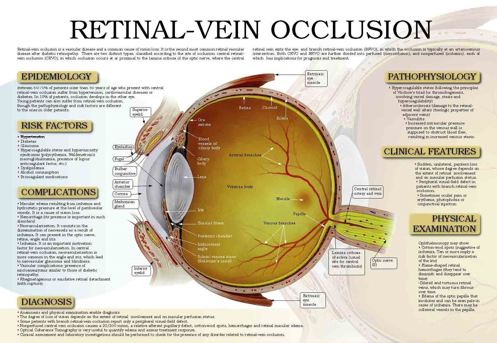 retinal vein occlusion 2